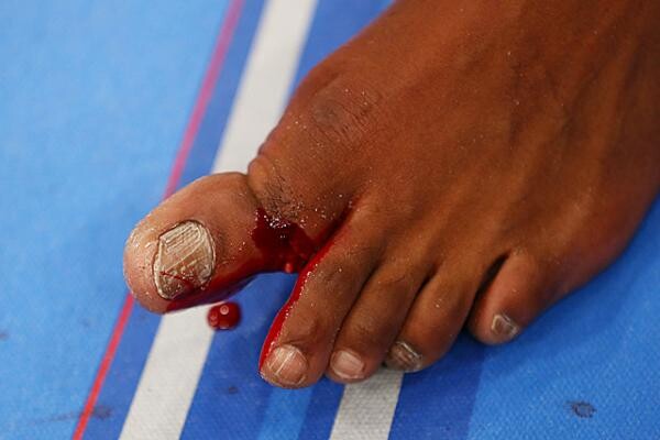 10 Most Horrifying Injuries In The History Of MMA 10 Most Horrifying Injuries In The History Of MMA