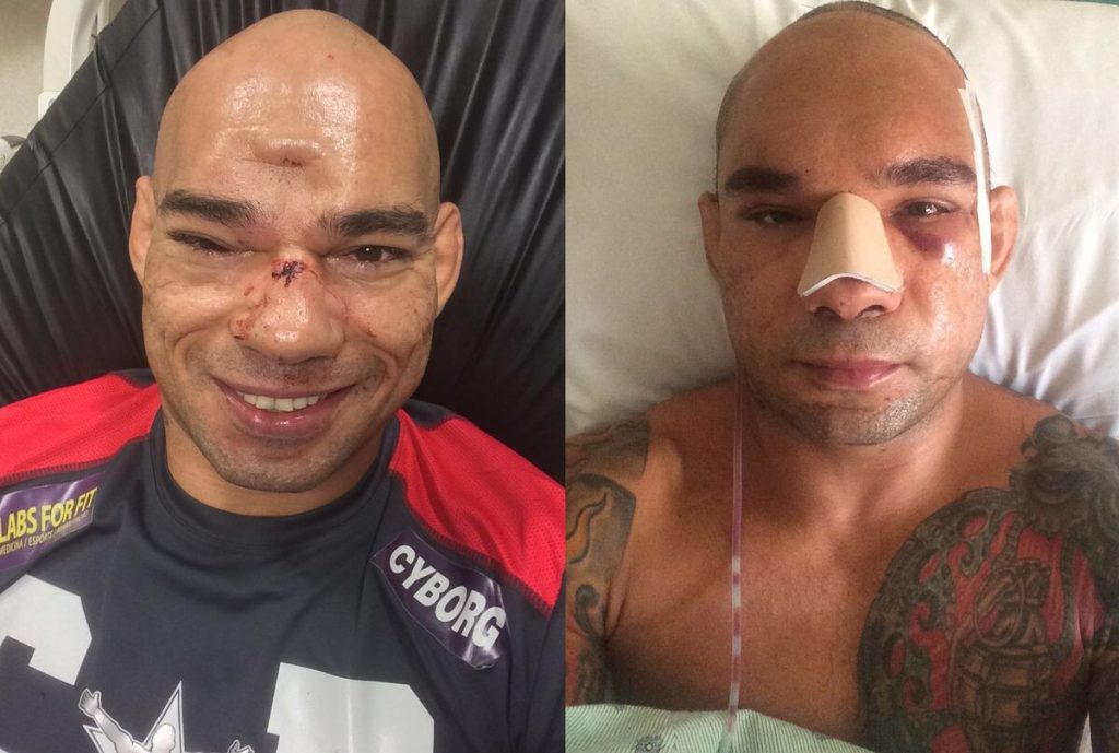 10 Most Horrifying Injuries In The History Of MMA 10 Most Horrifying Injuries In The History Of MMA