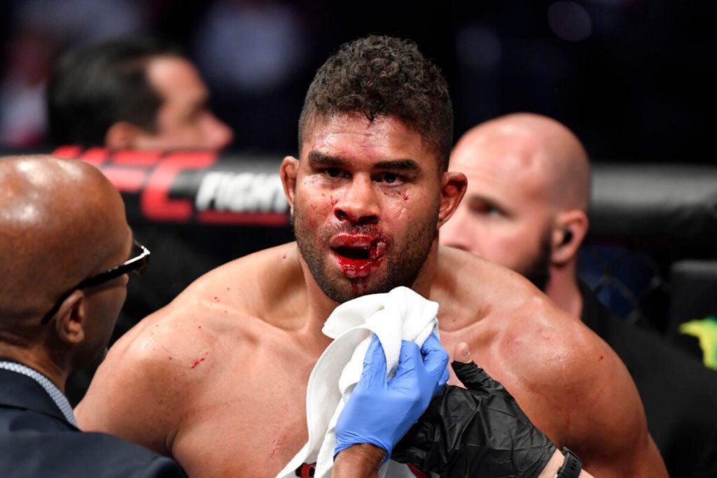 10 Most Horrifying Injuries In The History Of MMA 10 Most Horrifying Injuries In The History Of MMA