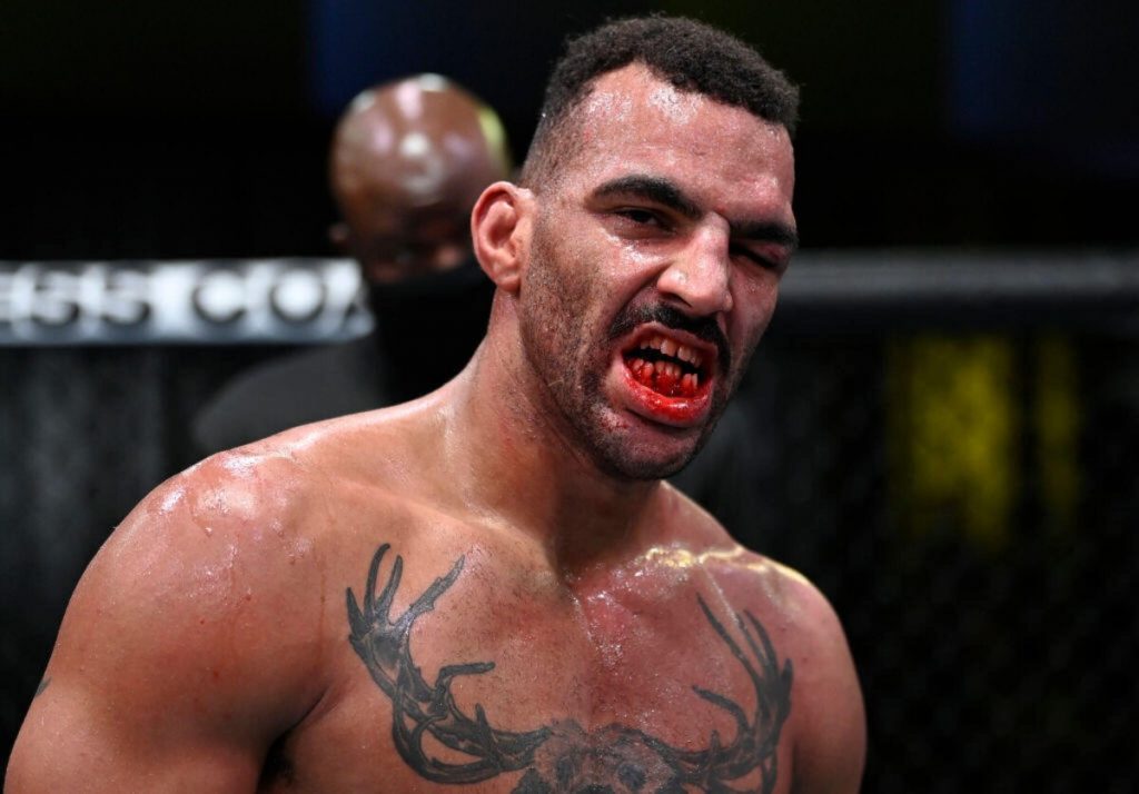 10 Most Horrifying Injuries In The History Of MMA 10 Most Horrifying Injuries In The History Of MMA