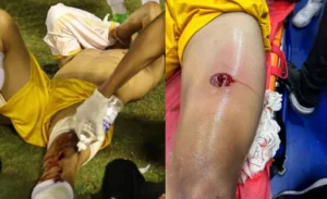 Police Shooting of Goalkeeper in Brazilian Soccer Match Sparks Outrage  