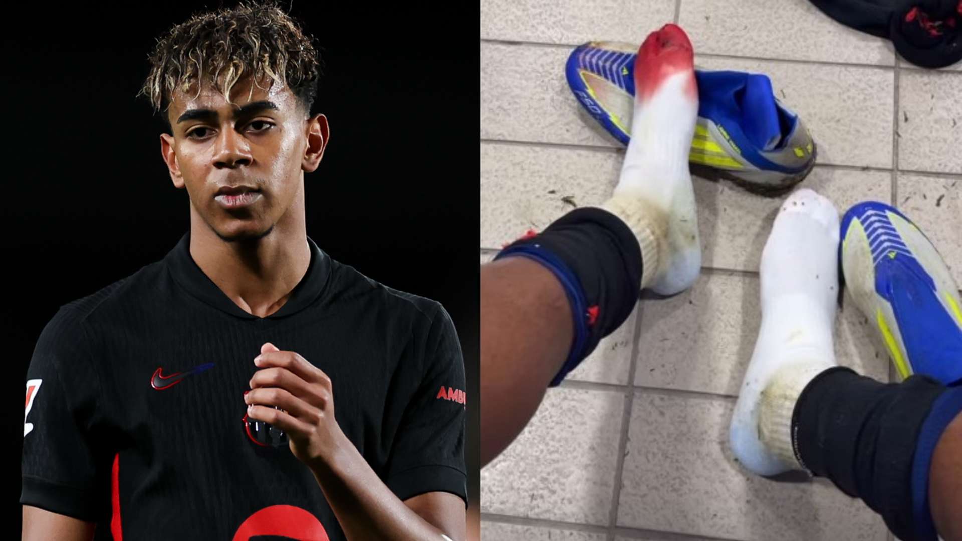 ‘Not a foul!’ – Officials bemuse bloodied Barca star Yamal  