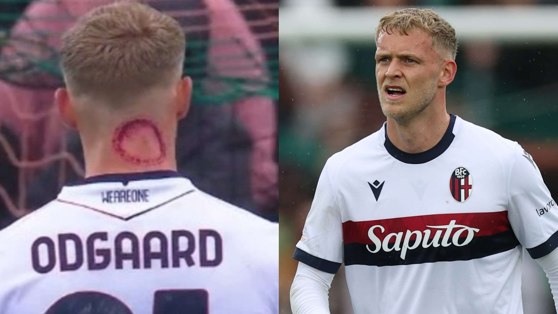 'Zombie bite' - Serie A star forced to explain gruesome 'injury'  