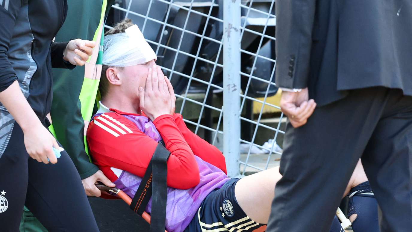 Aberdeen star hit in face by own fan's seat and injured  