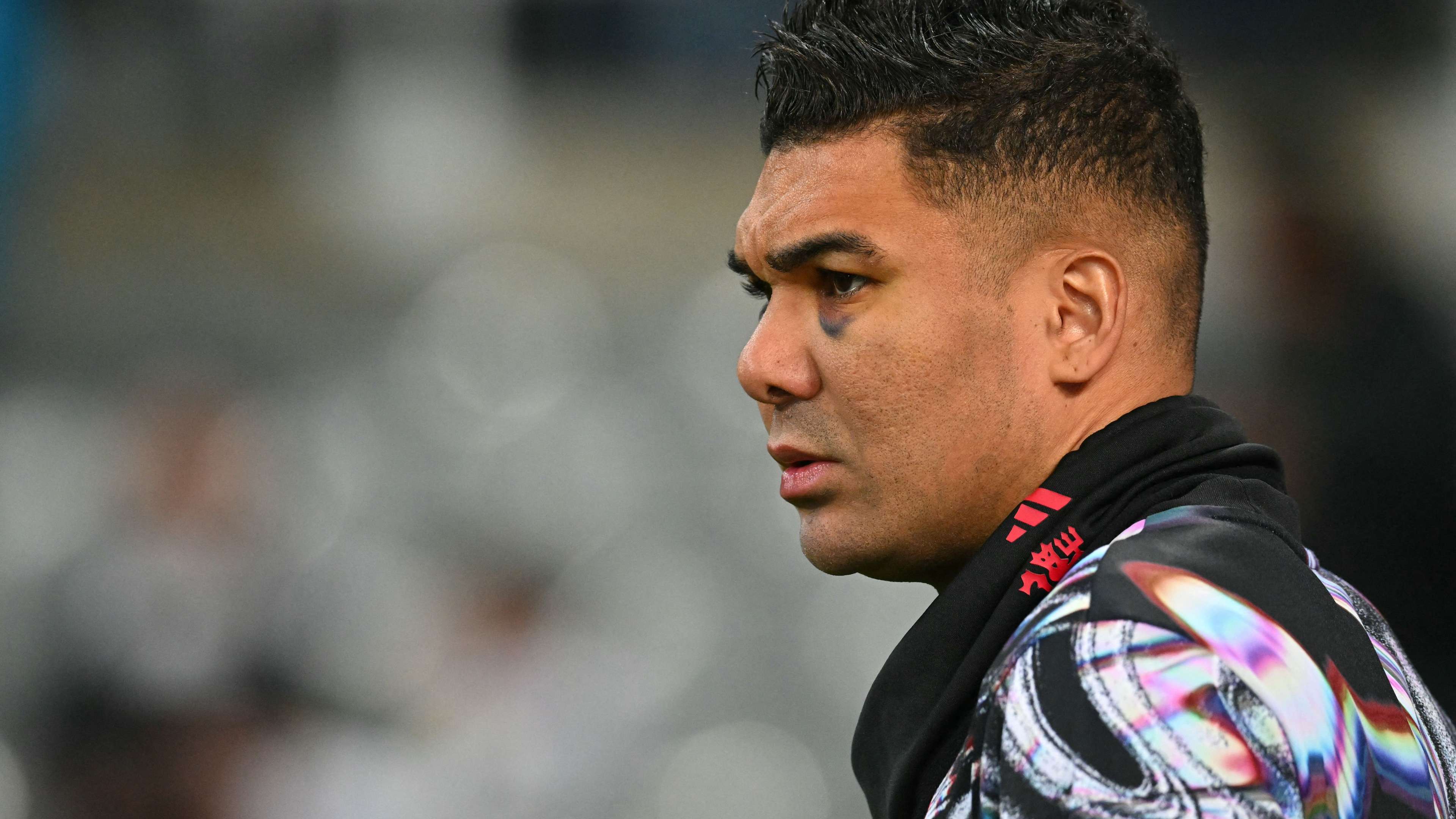 Cause of Casemiro's black eye revealed  